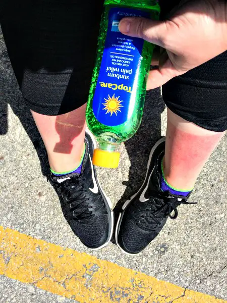 This is what happens when you forget to apply sunscreen while kayaking. (Erin Klema/The Epicurean Traveler)